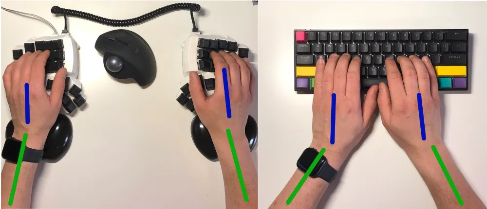 Wrist and forearm alignment comparison