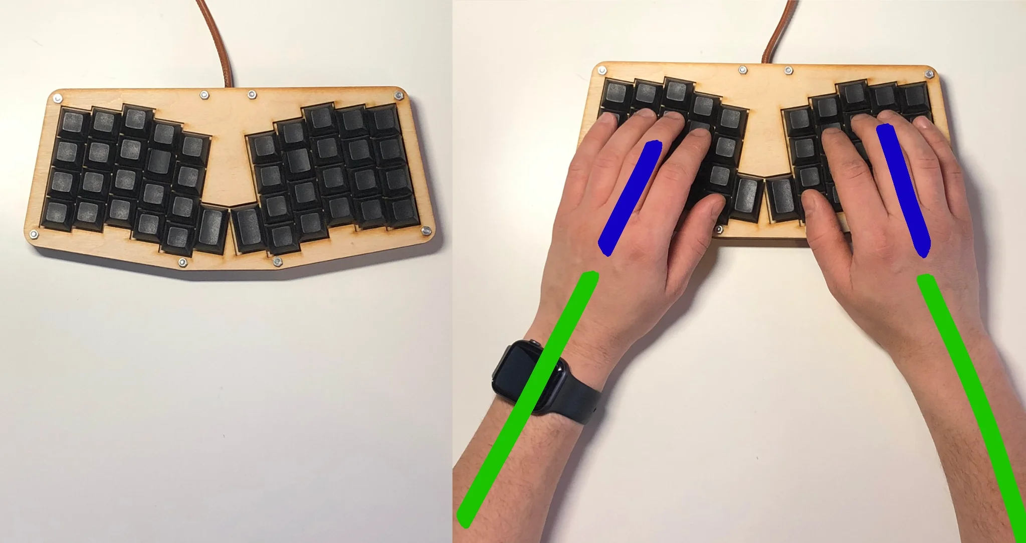 Hands on Atreus keyboard showing wrist alignment on semi-split